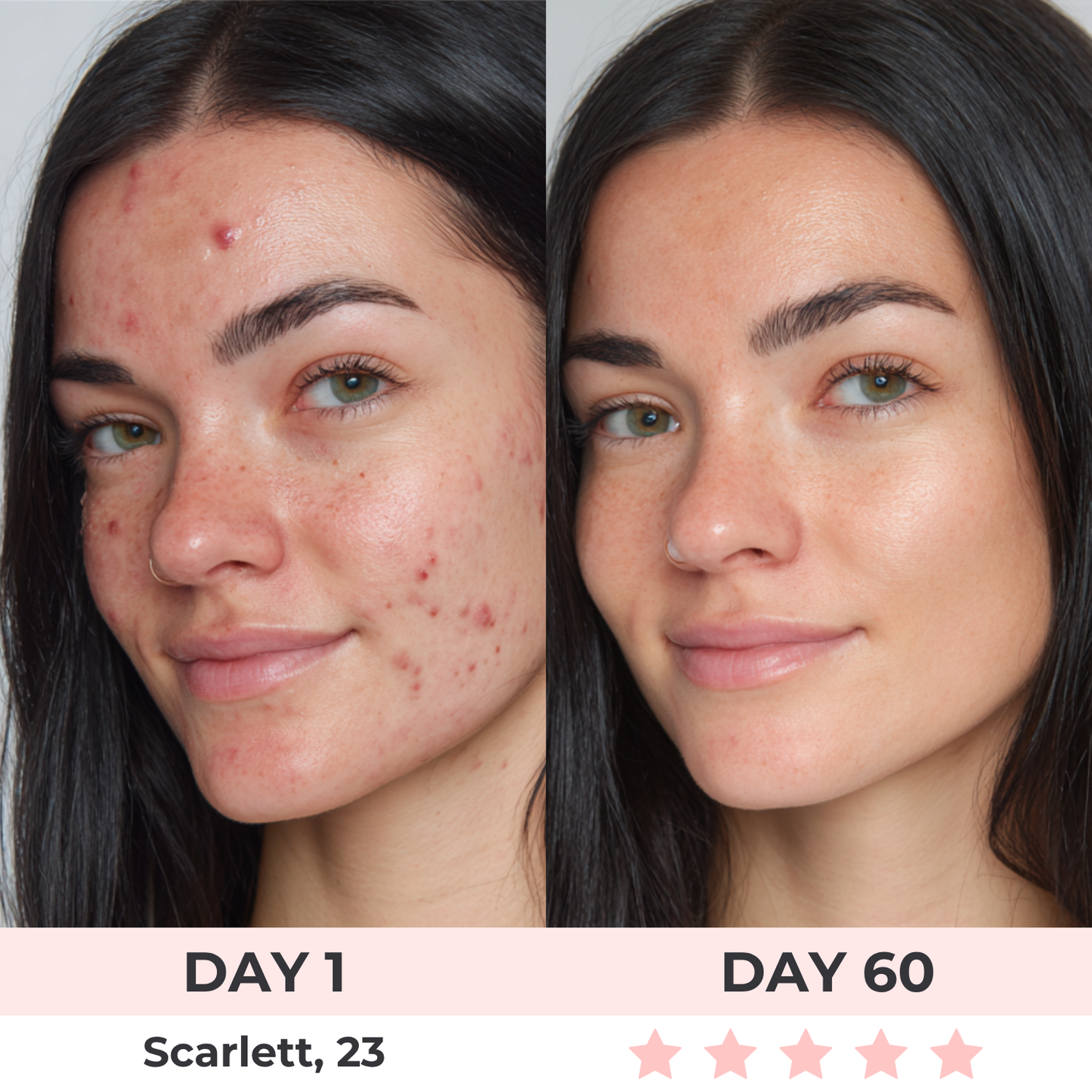 LumiLift Pro™ | 7-in-1 LED Facial Sculptor