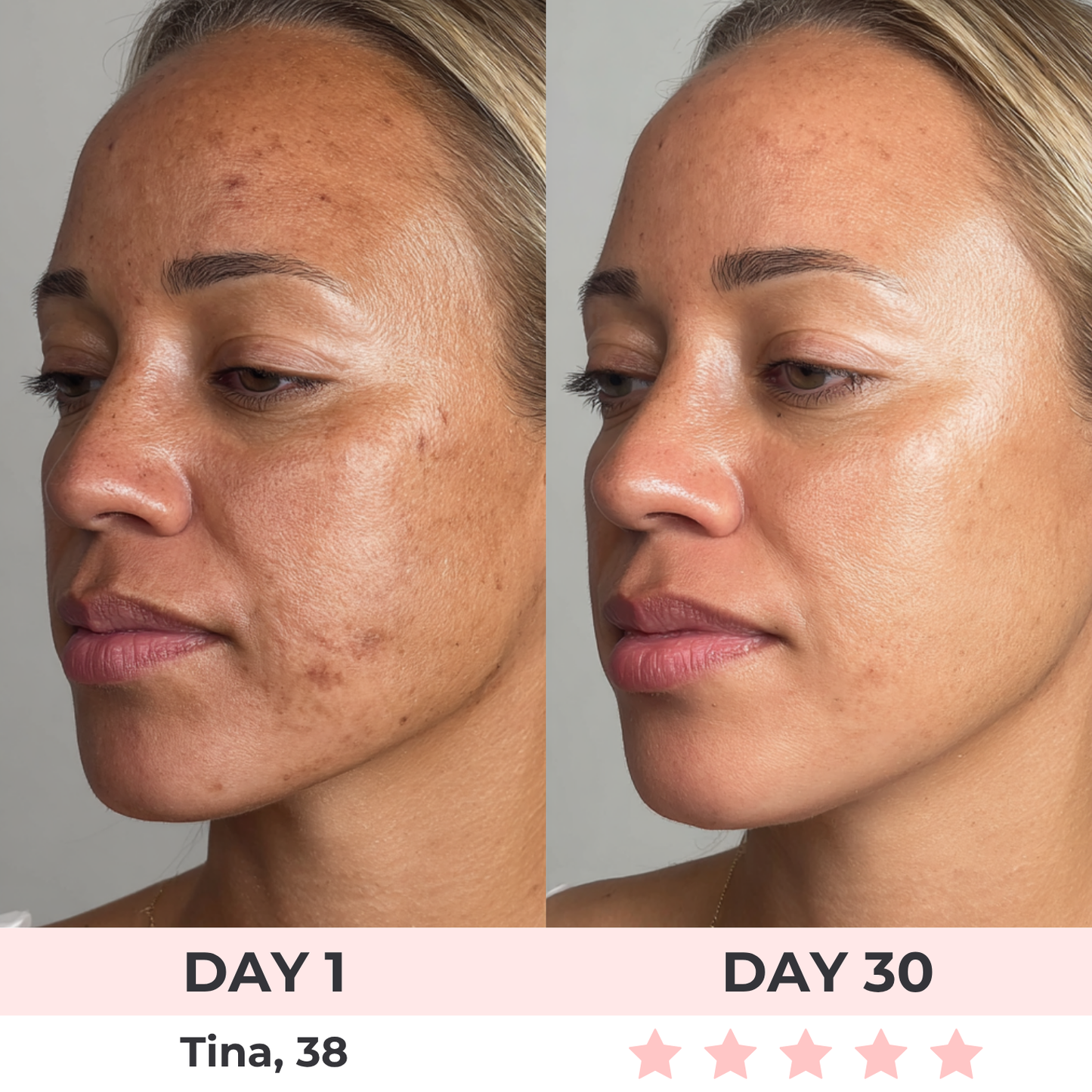 LumiLift Pro™ | 7-in-1 LED Facial Sculptor