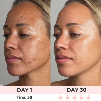 LumiLift Pro™ | 7-in-1 LED Facial Sculptor