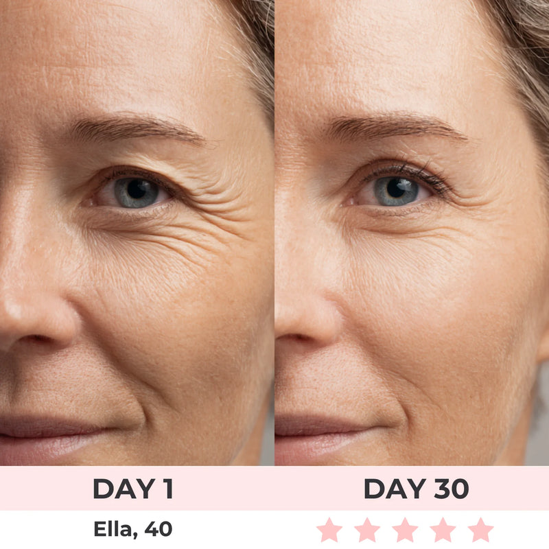 <p>''I couldn't be happier with the results after using the LumiLift Pro. The fine lines around my eyes have visibly softened, and my skin feels firmer and more youthful. This device has made me feel more confident in my appearance</p>